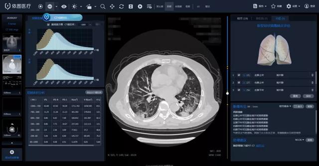 最新冠型肺炎与温馨日常生活的交织