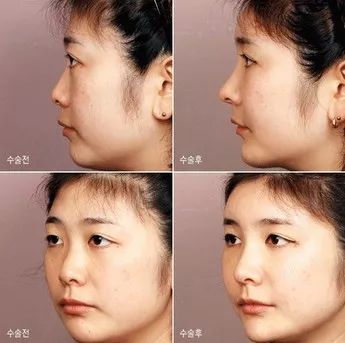 揭秘鼻子短的明星面部特征